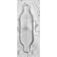 Placoneis abiskoensis