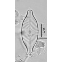 Placoneis explanata