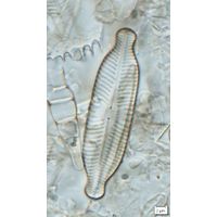 Placoneis elginensis