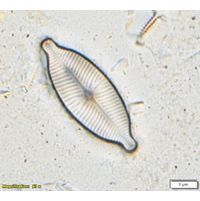 Placoneis symetrica