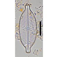 Placoneis symmetrica