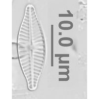 Planothidium delicatulum