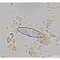 Planothidium lanceolatum