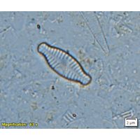 Planothidium amphibium