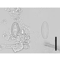 Platessa lutheri 