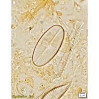Psammothidium bioretii
