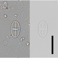 Psammothidium subatomoides 