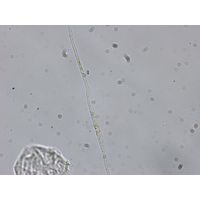 Pseudonitzschia pseudodelicatisima