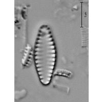 Pseudoastaurosira brevistriata
