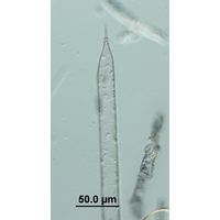 Rhizosolenia hebetata f. semispina
