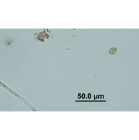 Rhizosolenia longiseta