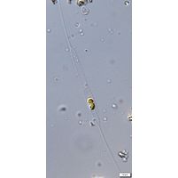 Rhizosolenia longiseta