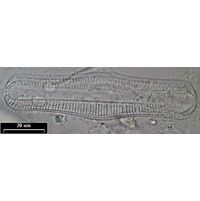 Rhopalodia gibba