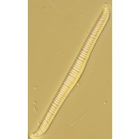Rhopalodia gibba