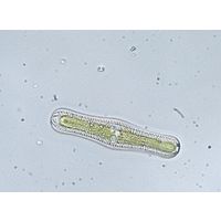 Rhopalodia gibba