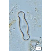 Sellaphora medioconvexa