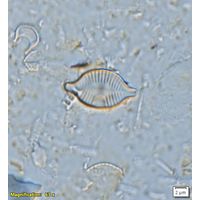 Skabitchewskia peragalloi