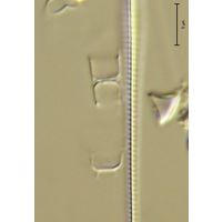 Skeletonema potamos