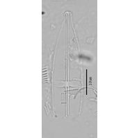 Stauroneis anceps