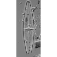 Stauroneis phoenicenteron