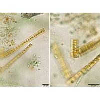 Staurosira construens
