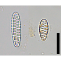 Staurosirella pinnata
