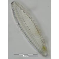 Surirella minuta