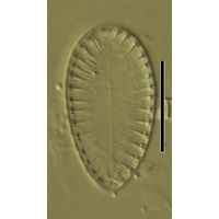 Surirella brebissoni