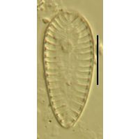 Surirella brebissoni