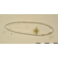 Surirella