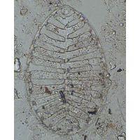 Surirella robusta