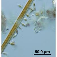 Synedra parasitica