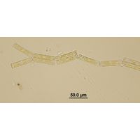 Tabellaria fenestrata