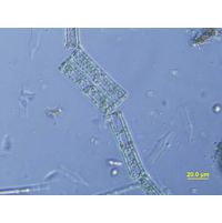 Tabellaria fenestrata