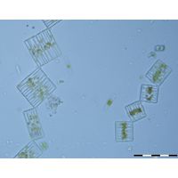 Tabellaria flocculosa