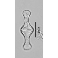 Tabellaria flocculosa