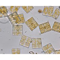 Tabellaria flocculosa