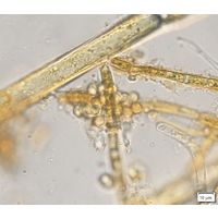 Chrysosphaera paludosa