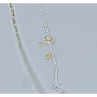 Chrysosphaera