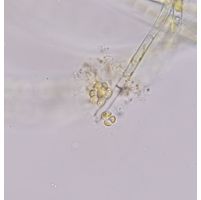 Chrysosphaera