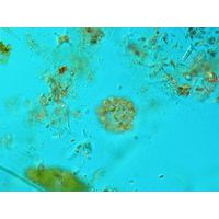Chrysosphaerella brevispina