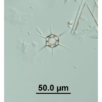 Dictyocha speculum