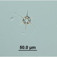 Dictyocha speculum