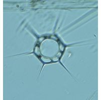 Dictyocha speculum