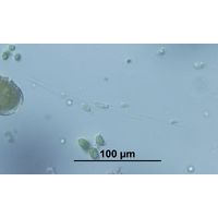 Dinobryon bavaricum