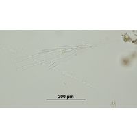Dinobryon bavaricum