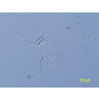 Dinobryon divergens