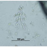 Dinobryon sertularia