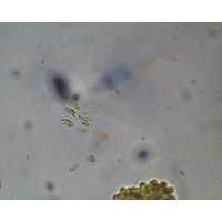 Dinobryon sertularia