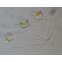 Dinobryon sertularia